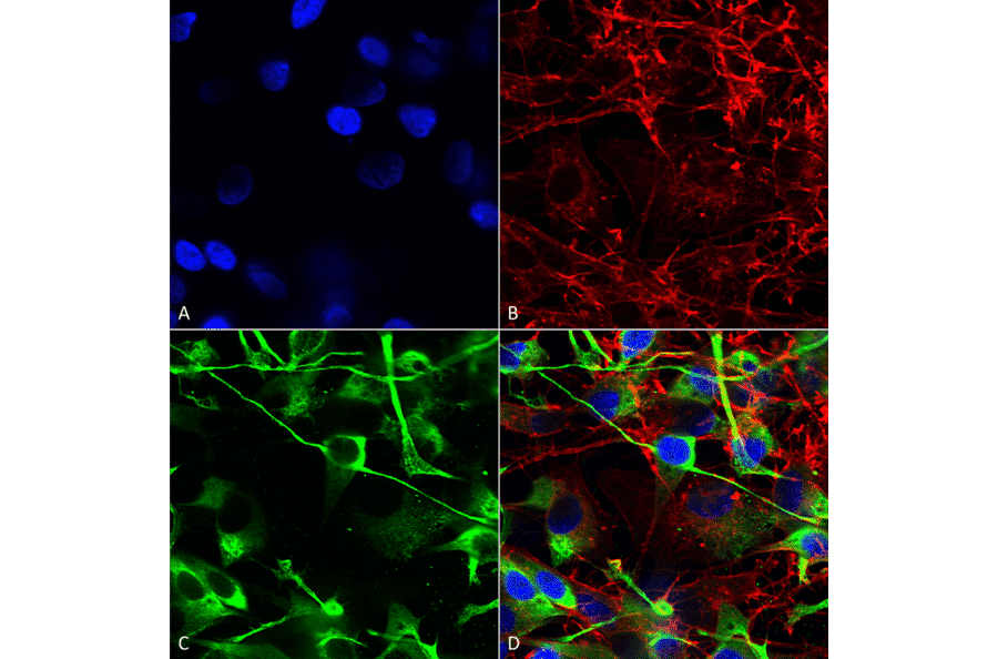 Immunocytochemistry/Immunofluorescence - Anti-NMDAR2A Antibody [S327-95] (A304974) - Antibodies.com