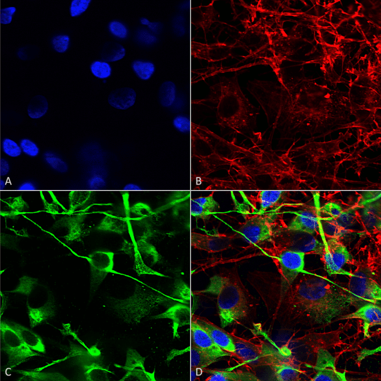 Immunocytochemistry/Immunofluorescence - Anti-NMDAR2A Antibody [S327-95] (A304974) - Antibodies.com