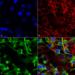 Immunocytochemistry/Immunofluorescence - Anti-NMDAR2A Antibody [S327-95] (A304974) - Antibodies.com