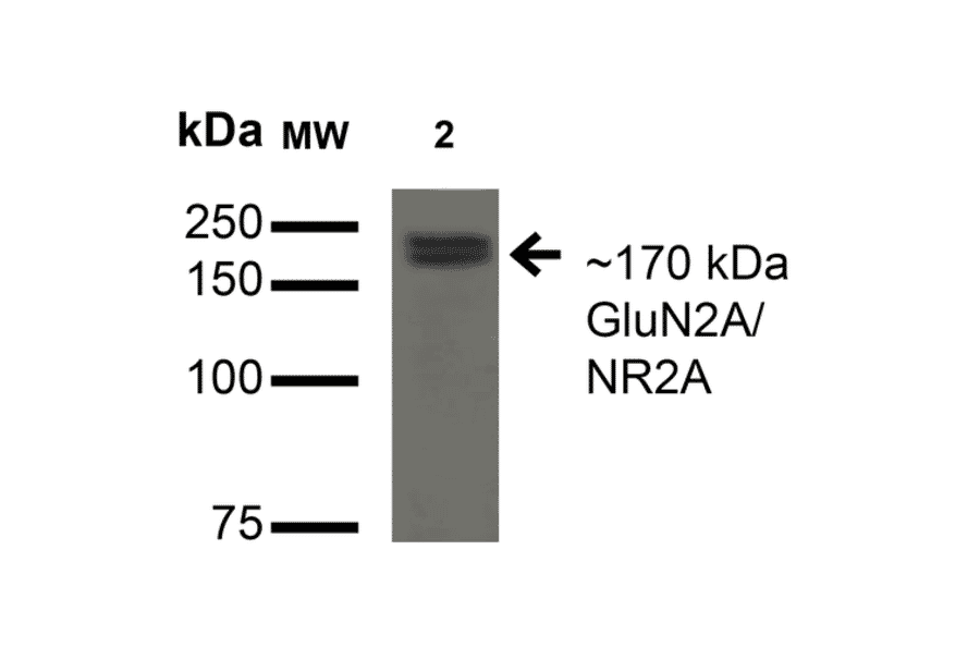 Western Blot - Anti-NMDAR2A Antibody [S327A-38] (A304975) - Antibodies.com