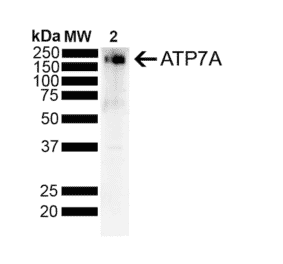 Western Blot - Anti-ATP7A Antibody [S60-4] (A304976) - Antibodies.com