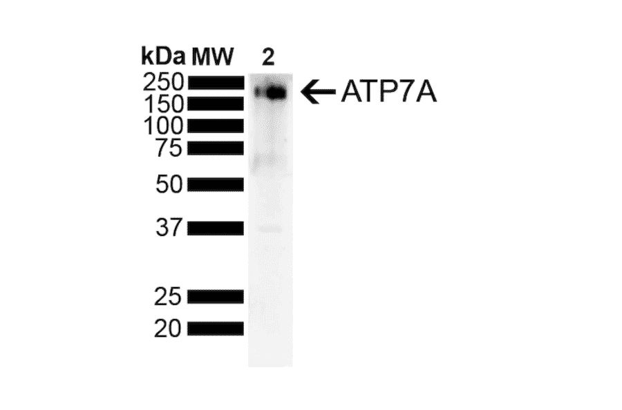 Western Blot - Anti-ATP7A Antibody [S60-4] (A304976) - Antibodies.com