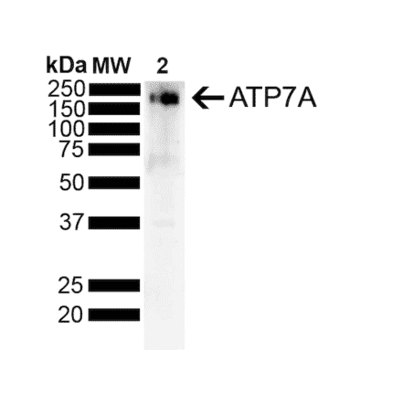 Western Blot - Anti-ATP7A Antibody [S60-4] (A304976) - Antibodies.com