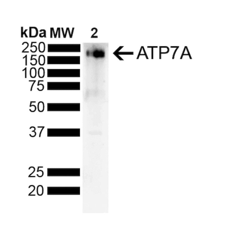 Western Blot - Anti-ATP7A Antibody [S60-4] (A304976) - Antibodies.com