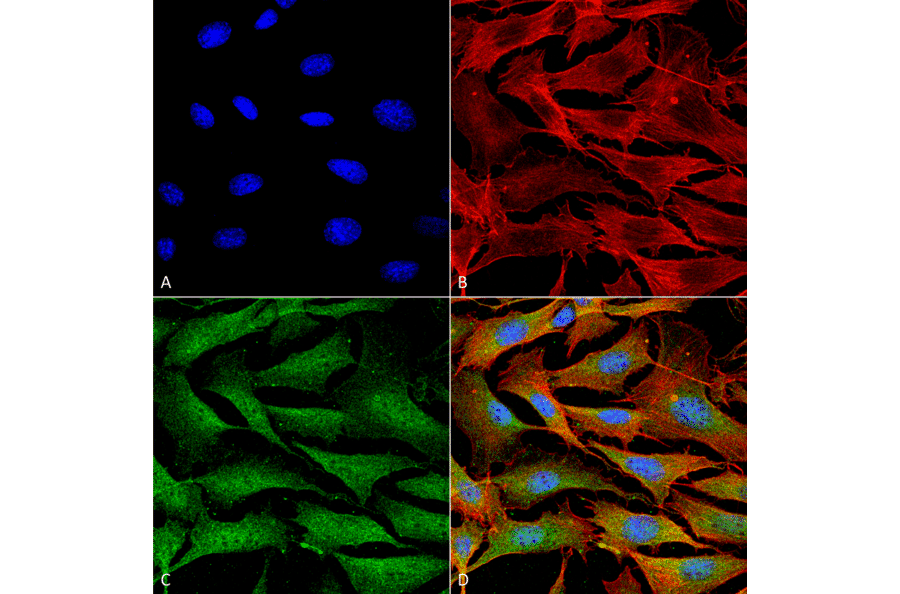 Immunocytochemistry/Immunofluorescence - Anti-ATP7A Antibody [S60-4] (A304976) - Antibodies.com