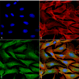 Immunocytochemistry/Immunofluorescence - Anti-ATP7A Antibody [S60-4] (A304976) - Antibodies.com