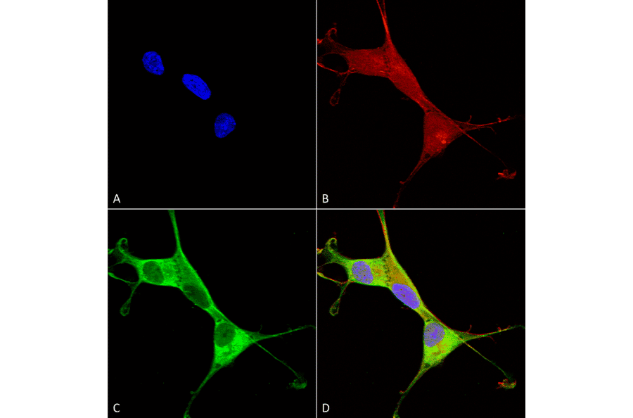 Immunocytochemistry/Immunofluorescence - Anti-ATP7A Antibody [S60-4] (A304976) - Antibodies.com