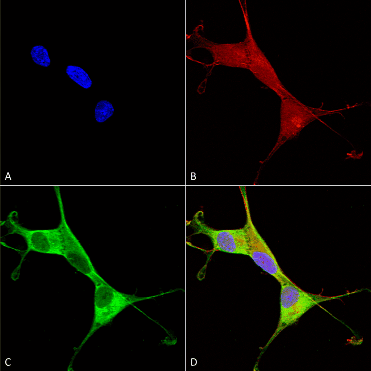 Immunocytochemistry/Immunofluorescence - Anti-ATP7A Antibody [S60-4] (A304976) - Antibodies.com
