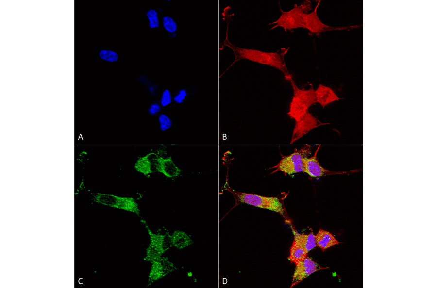 Immunocytochemistry/Immunofluorescence - Anti-NALCN Antibody [S187-7] (A304977) - Antibodies.com