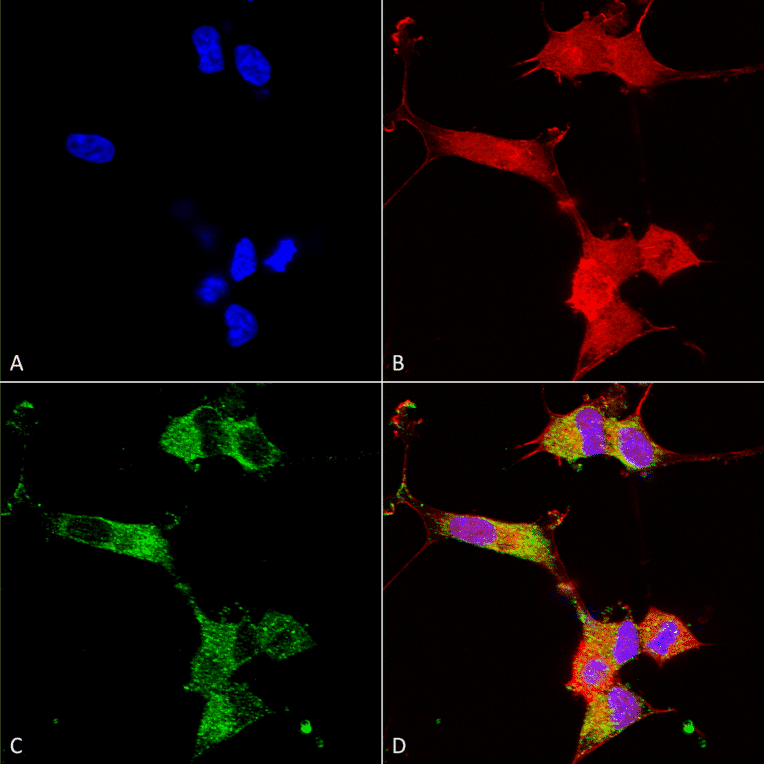 Immunocytochemistry/Immunofluorescence - Anti-NALCN Antibody [S187-7] (A304977) - Antibodies.com