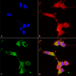 Immunocytochemistry/Immunofluorescence - Anti-NALCN Antibody [S187-7] (A304977) - Antibodies.com