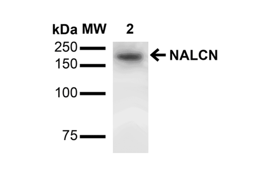 Western Blot - Anti-NALCN Antibody [S187-7] (A304977) - Antibodies.com