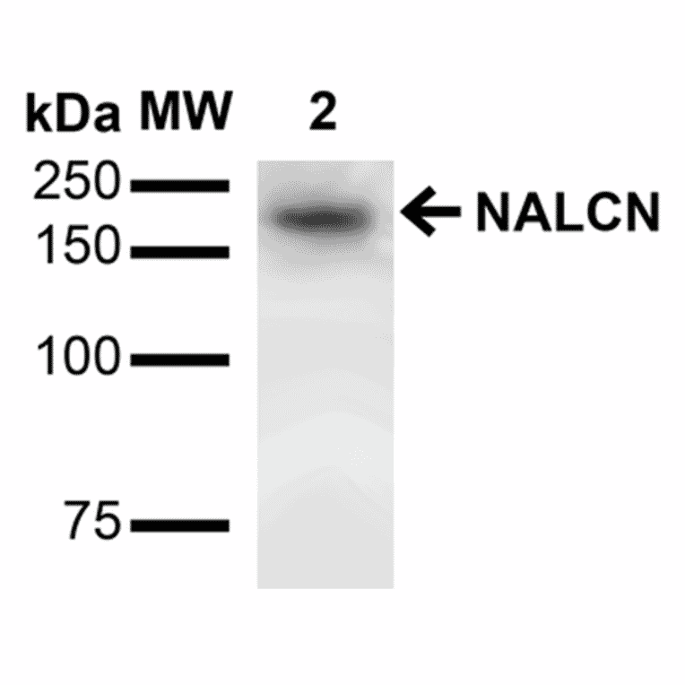 Western Blot - Anti-NALCN Antibody [S187-7] (A304977) - Antibodies.com