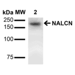 Western Blot - Anti-NALCN Antibody [S187-7] (A304977) - Antibodies.com