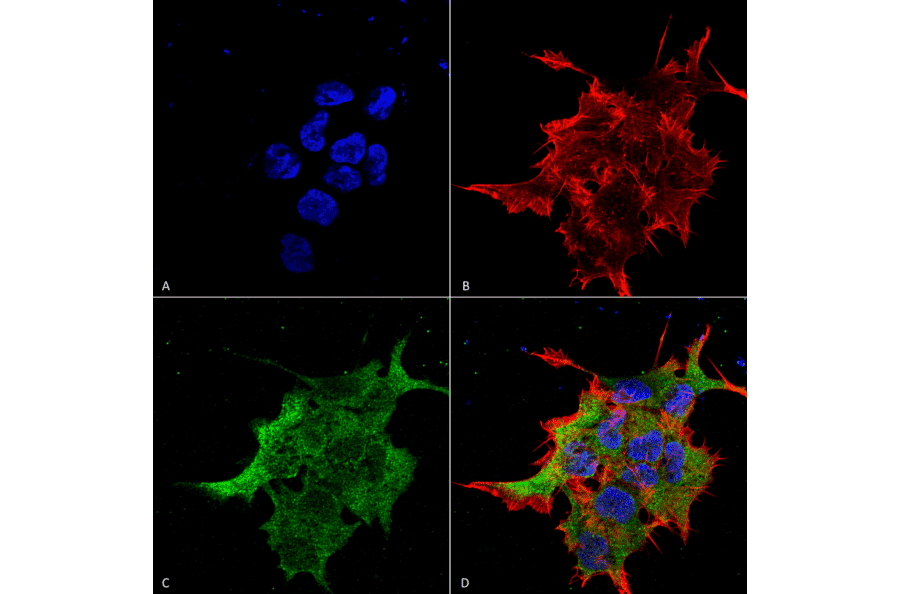 Immunocytochemistry/Immunofluorescence - Anti-NALCN Antibody [S187-7] (A304977) - Antibodies.com