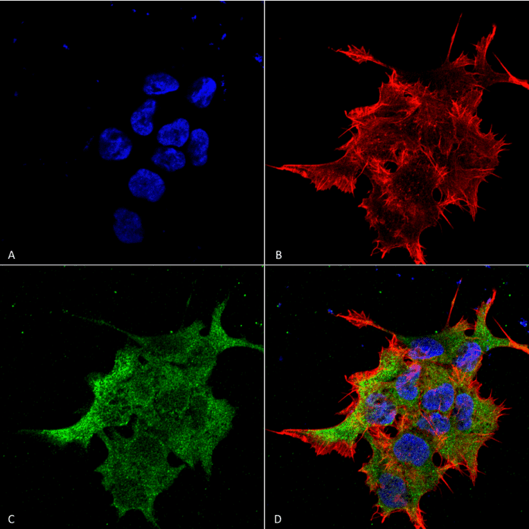 Immunocytochemistry/Immunofluorescence - Anti-NALCN Antibody [S187-7] (A304977) - Antibodies.com