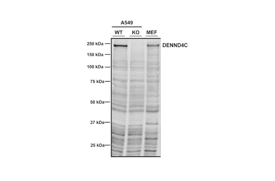 Western Blot - Anti-DENND4C Antibody [3E8] (A304978) - Antibodies.com