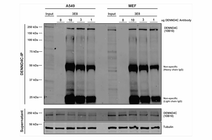 Immunoprecipitation - Anti-DENND4C Antibody [3E8] (A304978) - Antibodies.com