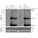 Immunoprecipitation - Anti-DENND4C Antibody [3E8] (A304978) - Antibodies.com