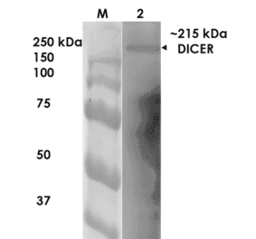 Western Blot - Anti-Dicer Antibody [S167-7] (A304979) - Antibodies.com