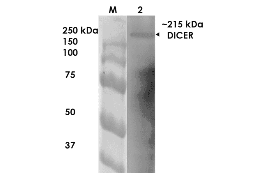 Western Blot - Anti-Dicer Antibody [S167-7] (A304979) - Antibodies.com