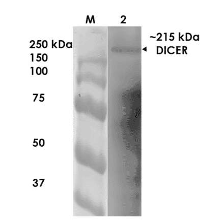Western Blot - Anti-Dicer Antibody [S167-7] (A304979) - Antibodies.com