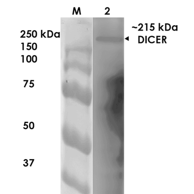 Western Blot - Anti-Dicer Antibody [S167-7] (A304979) - Antibodies.com