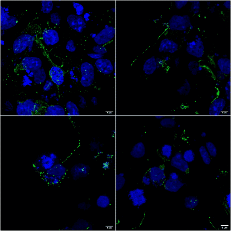 Immunocytochemistry/Immunofluorescence - Anti-LRP4 Antibody [S207-27] (A304980) - Antibodies.com