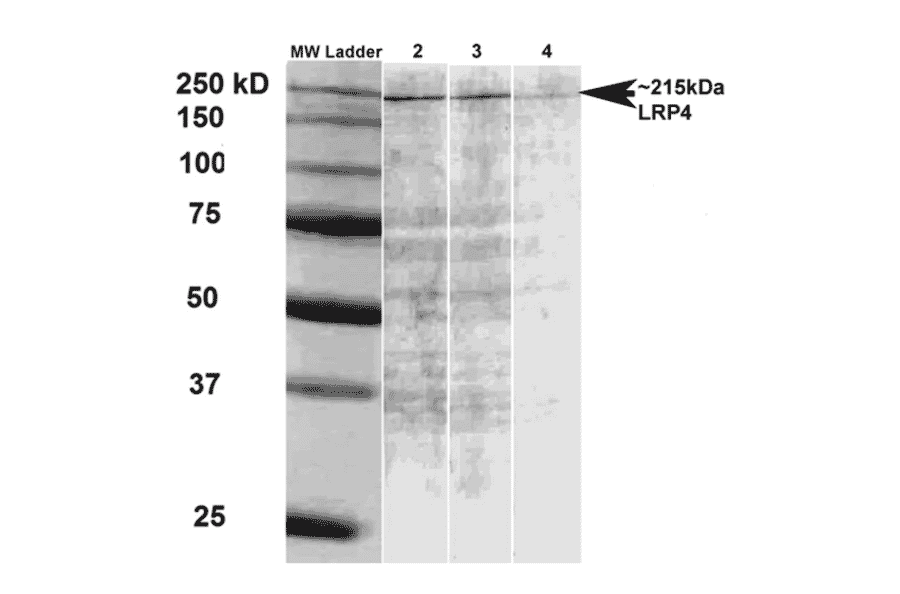 Western Blot - Anti-LRP4 Antibody [S207-27] (A304980) - Antibodies.com