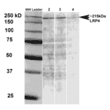 Western Blot - Anti-LRP4 Antibody [S207-27] (A304980) - Antibodies.com