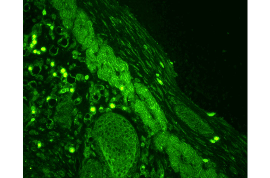 Immunohistochemistry - Anti-Rab4 Antibody (A304983) - Antibodies.com