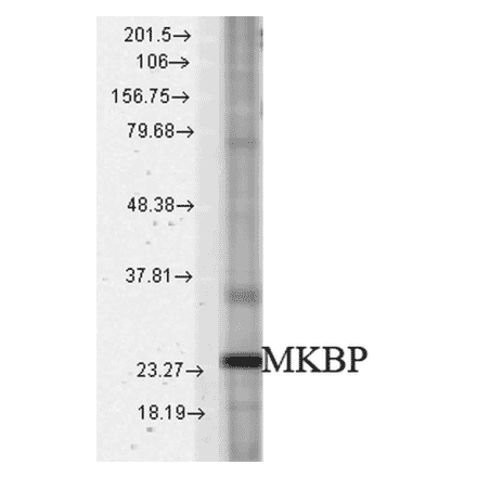 Western Blot - Anti-Hsp27 Antibody (A304984) - Antibodies.com