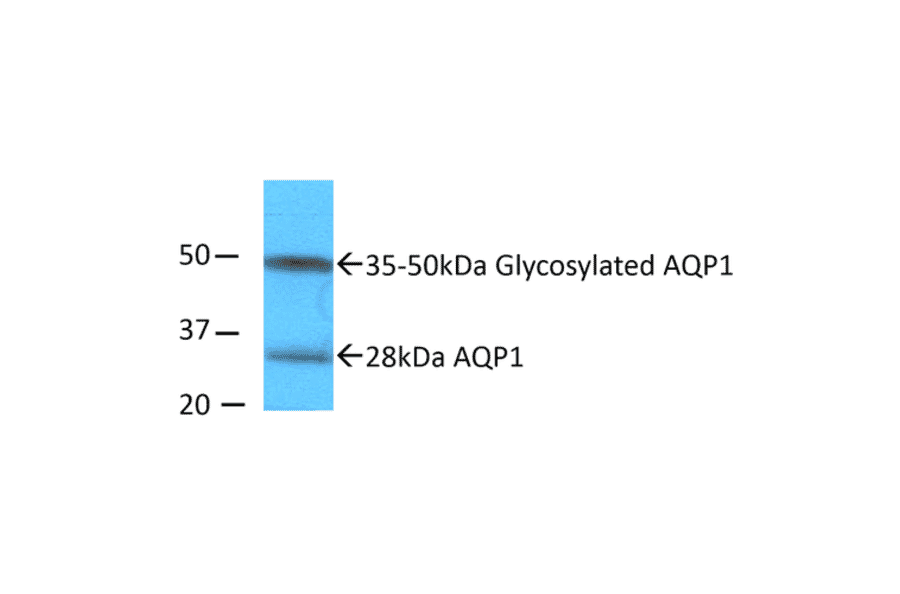 Western Blot - Anti-Aquaporin 1 Antibody (A304985) - Antibodies.com