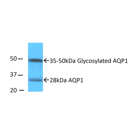 Western Blot - Anti-Aquaporin 1 Antibody (A304985) - Antibodies.com
