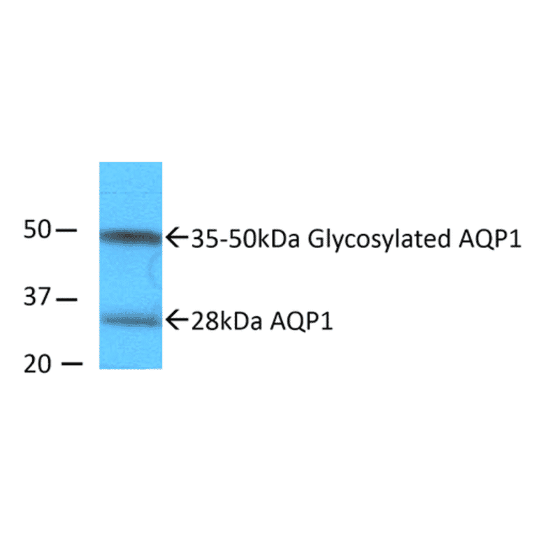 Western Blot - Anti-Aquaporin 1 Antibody (A304985) - Antibodies.com