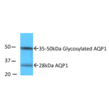 Western Blot - Anti-Aquaporin 1 Antibody (A304985) - Antibodies.com