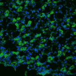 Immunohistochemistry - Anti-Aquaporin 1 Antibody (A304985) - Antibodies.com