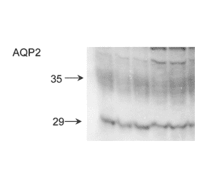 Western Blot - Anti-Aquaporin 2 Antibody (A304986) - Antibodies.com