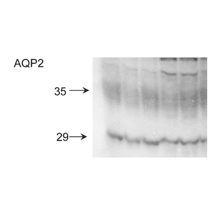 Western Blot - Anti-Aquaporin 2 Antibody (A304986) - Antibodies.com