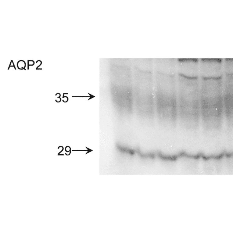 Western Blot - Anti-Aquaporin 2 Antibody (A304986) - Antibodies.com