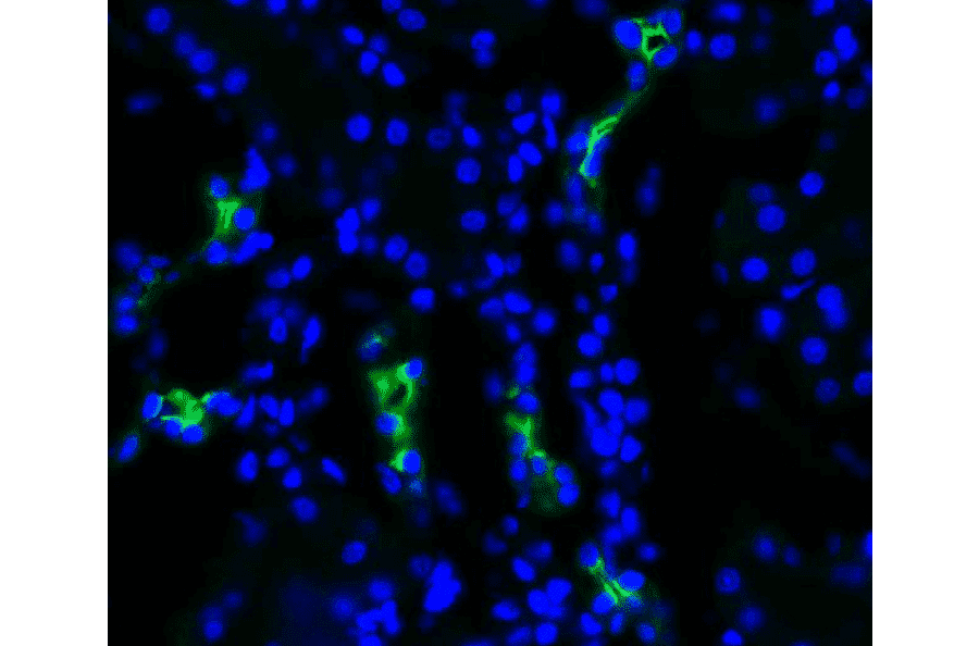 Immunohistochemistry - Anti-Aquaporin 2 Antibody (A304986) - Antibodies.com
