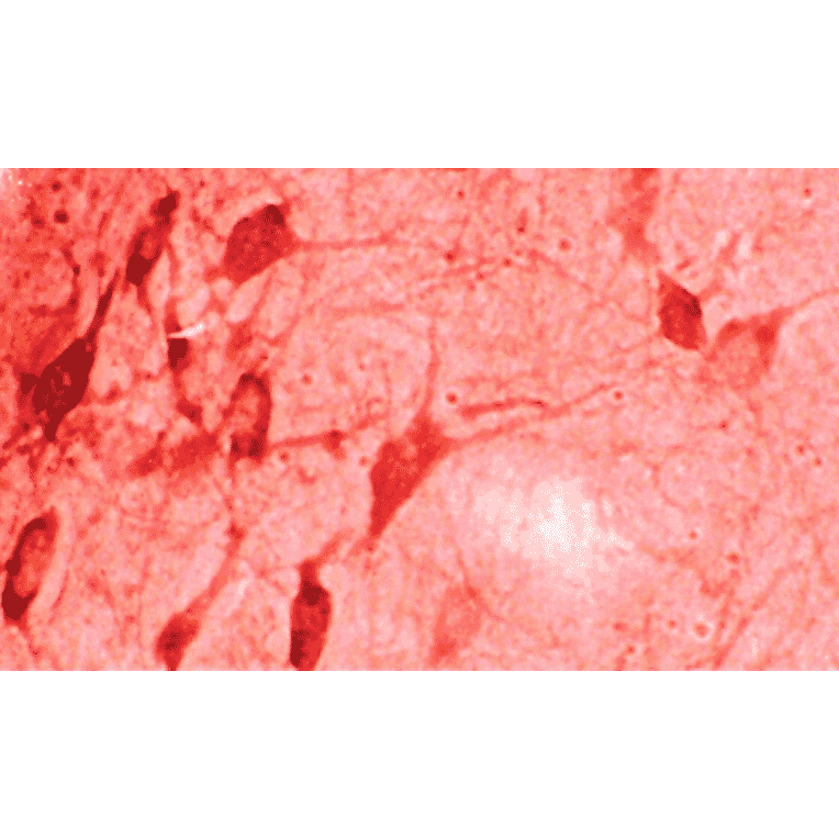 Immunohistochemistry - Anti-Heme Oxygenase 1 Antibody (A304988) - Antibodies.com