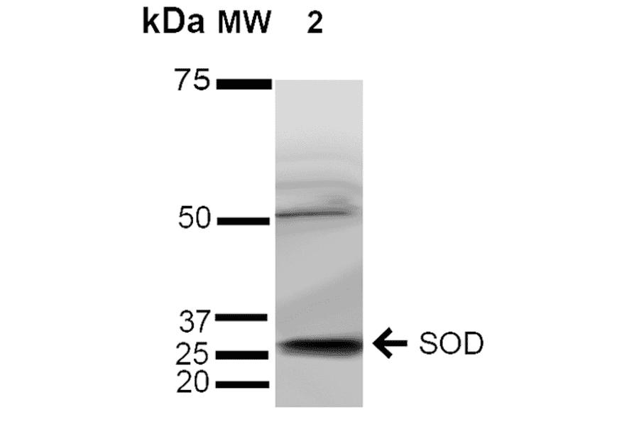 Western Blot - Anti-Superoxide Dismutase 3 / EC-SOD Antibody (A304989) - Antibodies.com