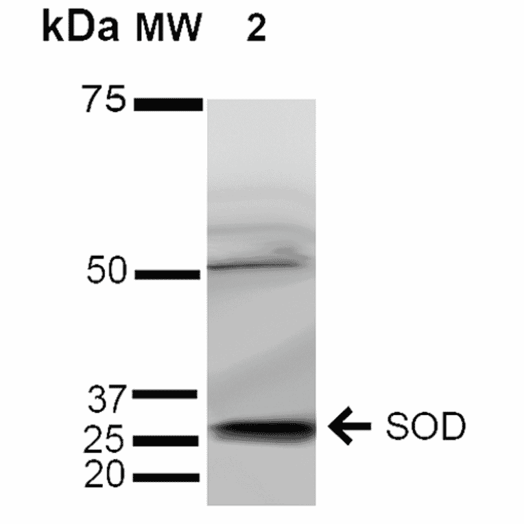 Western Blot - Anti-Superoxide Dismutase 3 / EC-SOD Antibody (A304989) - Antibodies.com