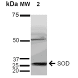 Western Blot - Anti-Superoxide Dismutase 3 / EC-SOD Antibody (A304989) - Antibodies.com