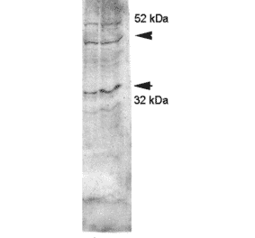 Western Blot - Anti-Aquaporin 4 Antibody (A304990) - Antibodies.com