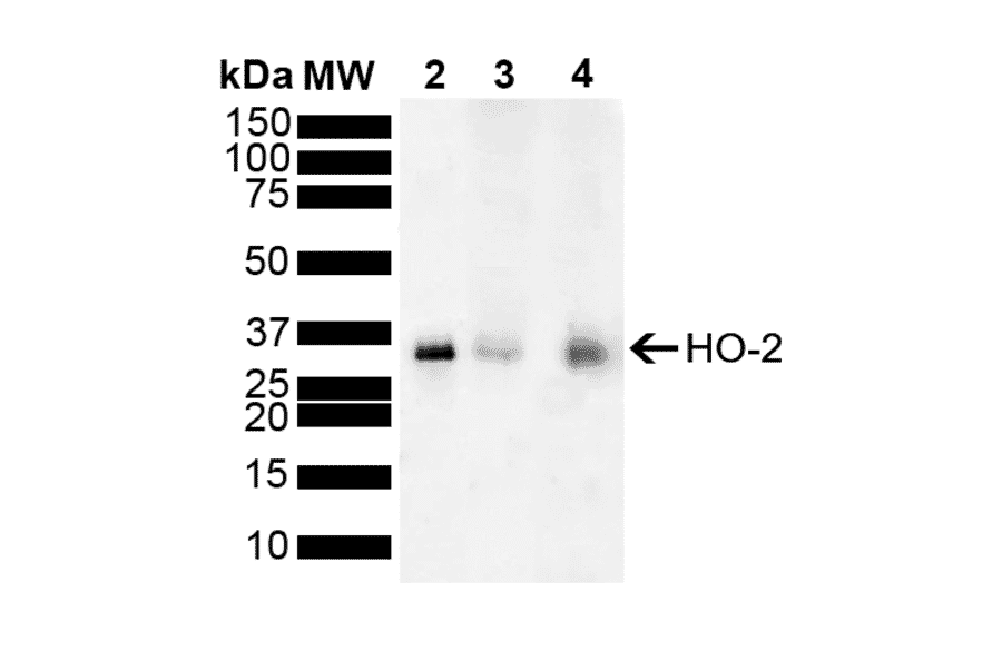 Western Blot - Anti-HO-2 Antibody (A304991) - Antibodies.com