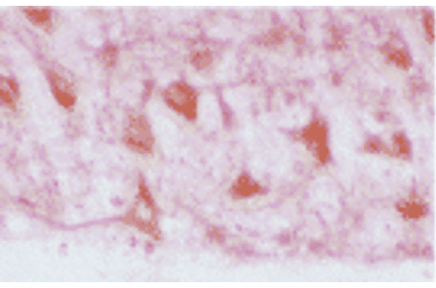 Immunohistochemistry - Anti-HO-2 Antibody (A304992) - Antibodies.com