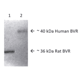 Western Blot - Anti-BVR Antibody (A304993) - Antibodies.com