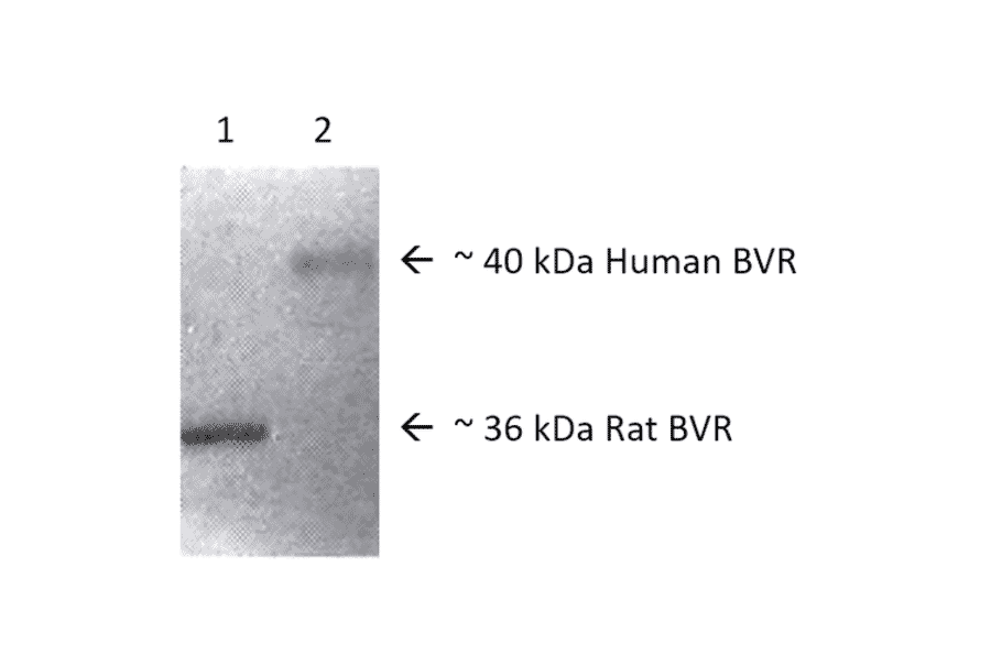 Western Blot - Anti-BVR Antibody (A304993) - Antibodies.com